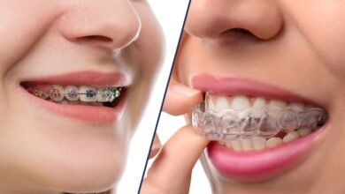 invisalign vs braces cost